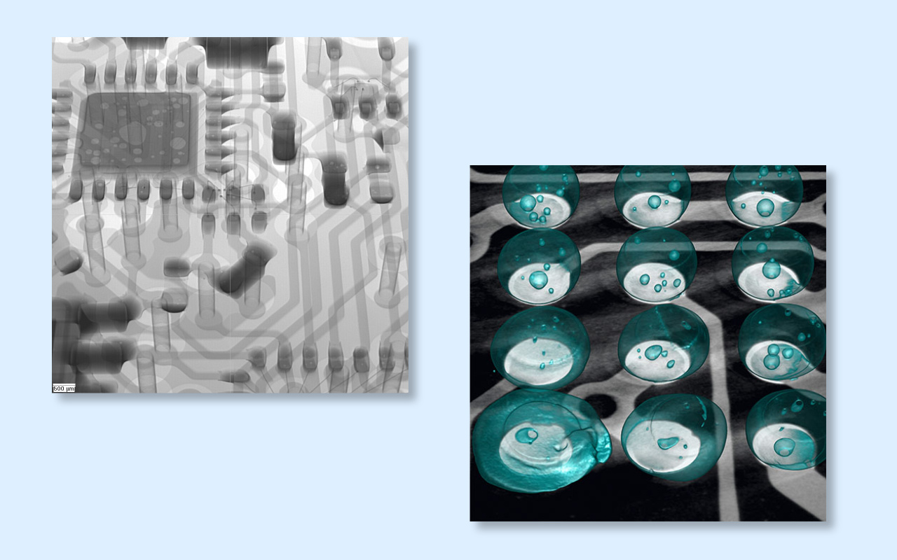 4. 2D vs 3D CT X-ray Which One Do You Really Need? 4. 2D vs 3D CT-röntgen Kumpaa todella tarvitset?