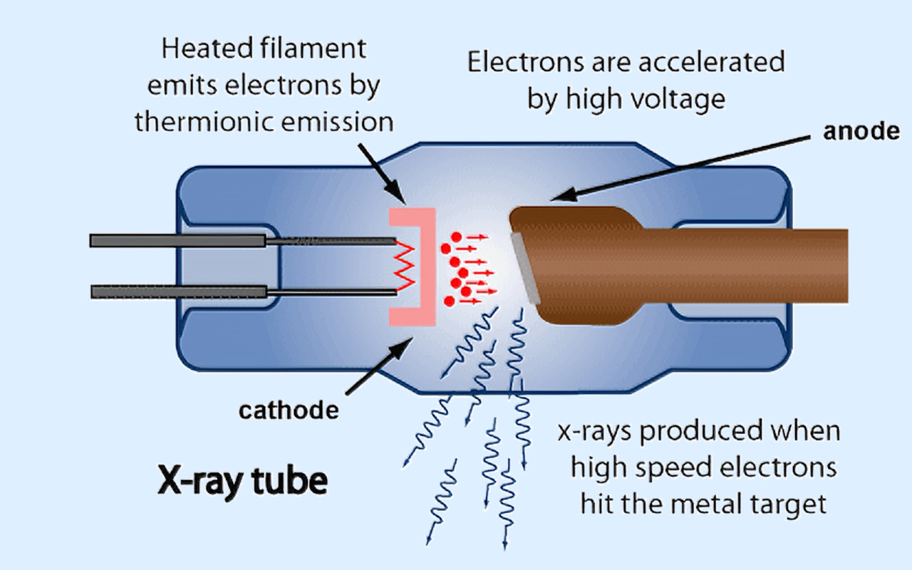 2. What X-ray Technology Actually Does 2. Mitä röntgentekniikka todella tekee