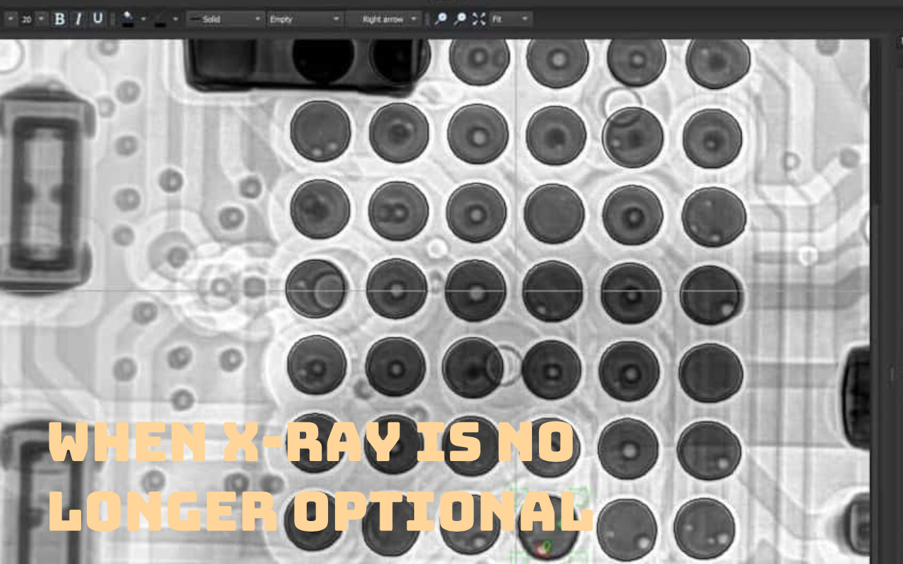 7. Kun r&ouml;ntgenpalaute tulee pakolliseksi